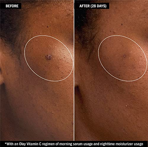 Olay Vitamin C + Peptide 24 Brightening Face Serum + Whip Moisturizer Travel/Trial Size Gift Set - Image 4